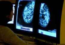 Young Cancer Patients Share Common Dietary Habit, Doctor Reveals news-16082024-192143