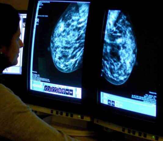 Young Cancer Patients Share Common Dietary Habit, Doctor Reveals news-16082024-192143