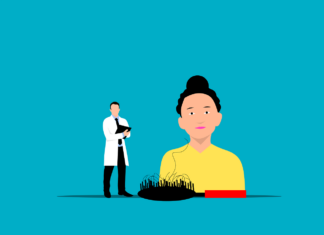 Unveiling the FUE Hair Transplant Process: A Step-by-Step Guide to Restoring Your Hair