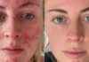 Birmingham Live: Best Dermatologist-Approved Anti-Blemish Serum for Boosting Confidence birmingham-live-best-dermatologist-approved-anti-blemish-serum-for-boosting-confidence